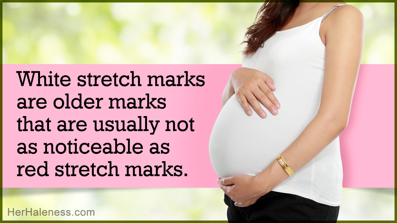 Difference Between Red and White Stretch Marks